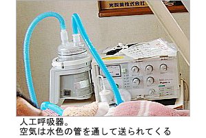 写真：人工呼吸器。呼吸器からのびた管が平本さんののどにつながっている。空気が管を通して送られてくる 