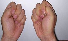 写真：右手と左手。ともに握り拳。